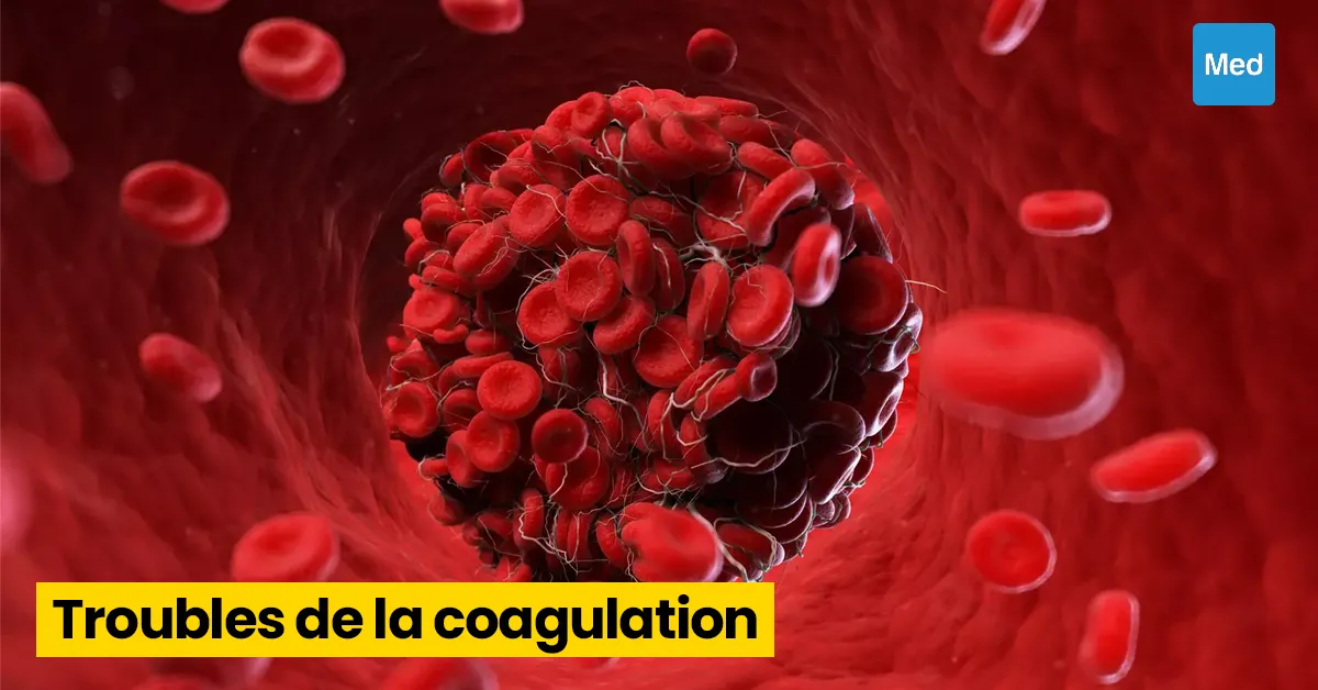 Troubles de la coagulation